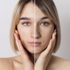 Gen Factor Treatment 3 Sessions
