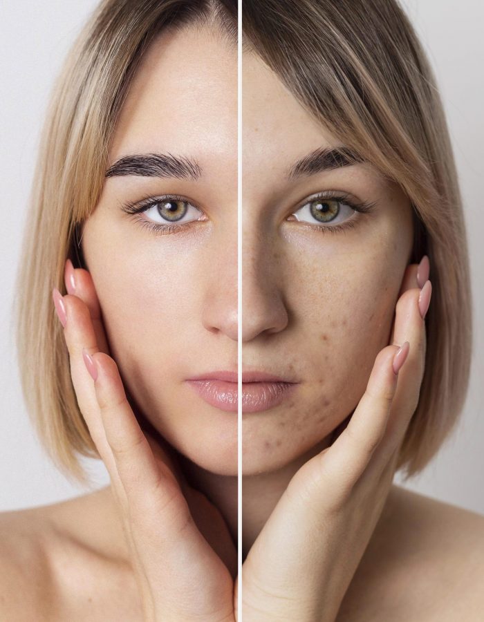 Gen Factor Treatment 3 Sessions