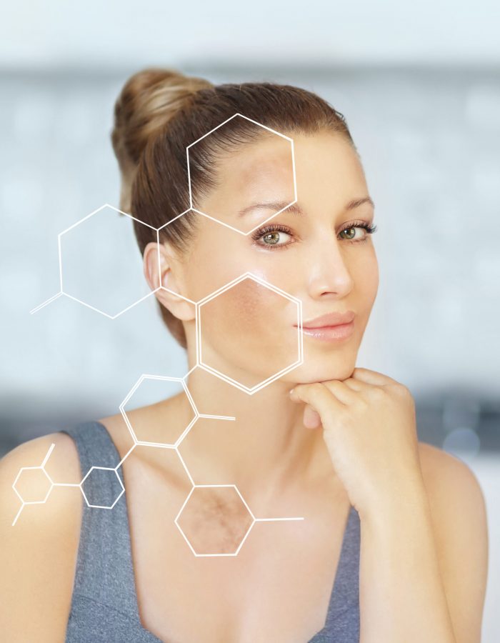 UNITONE  Discolorations Treatment – 6 sessions
